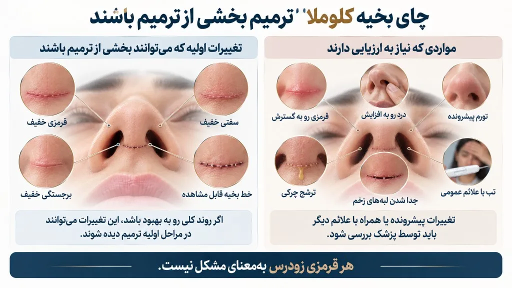 جای بخیه کلوملا؛ ترمیم طبیعی یا نیازمند بررسی؟