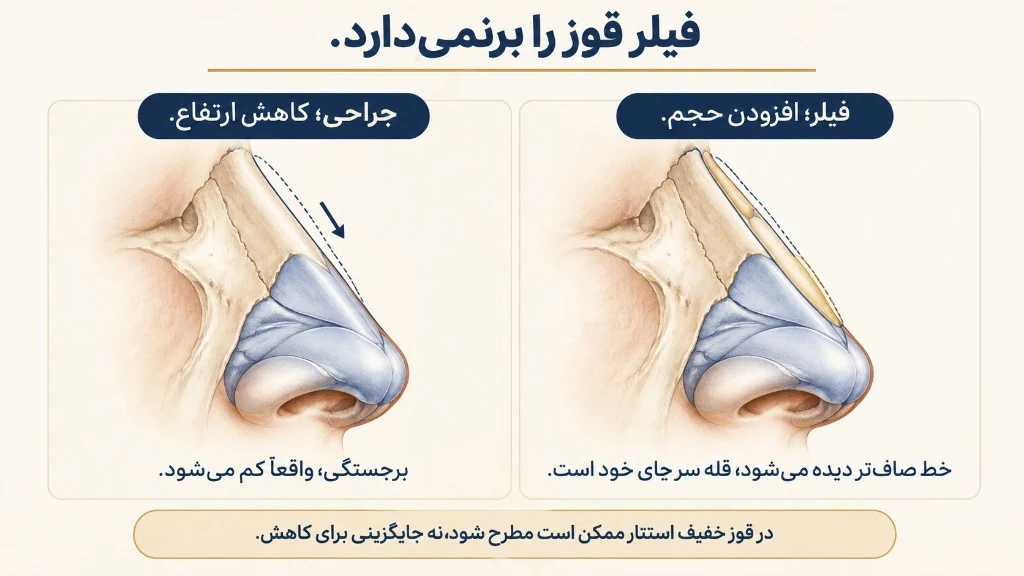 کاهش جراحی در برابر استتار با فیلر