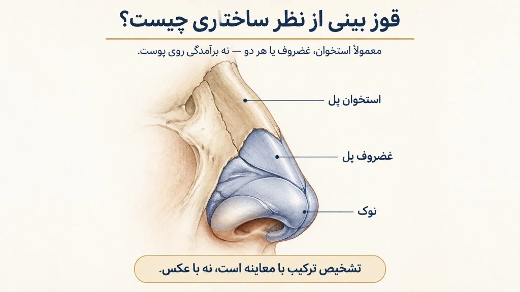 آنچه در معاینه قوز بررسی می‌شود