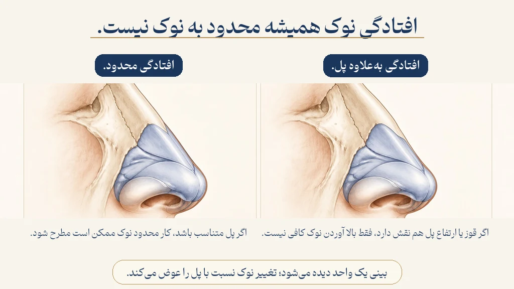 افتادگی محدود در برابر افتادگی همراه با پل