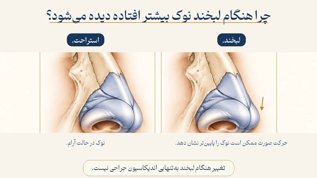 نوک در استراحت در برابر هنگام لبخند