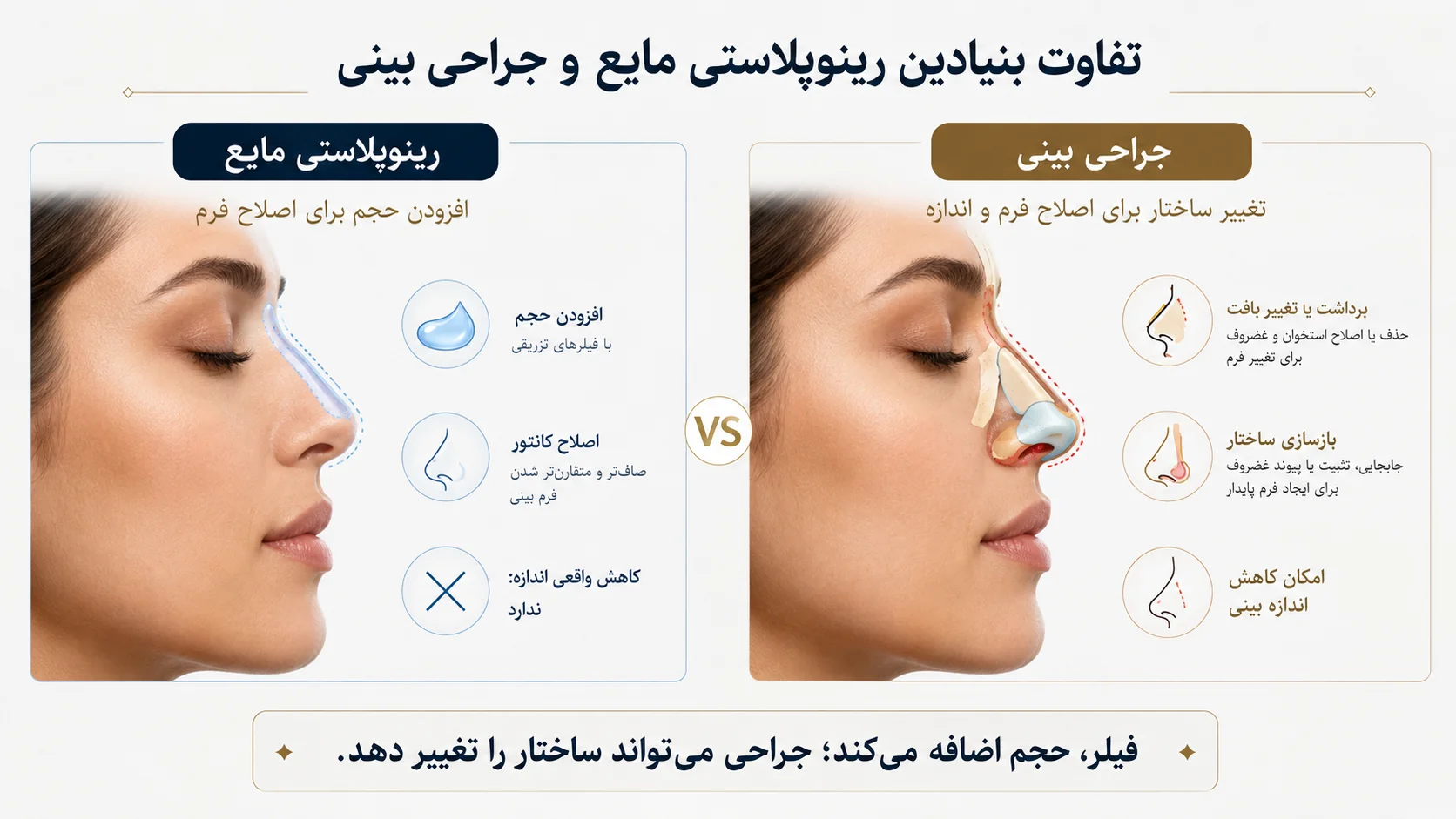 تفاوت بنیادین رینوپلاستی مایع و جراحی بینی