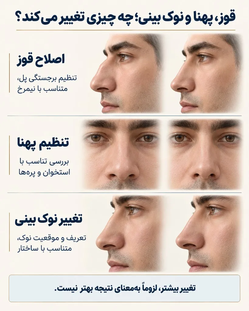 قوز، پهنا و نوک بینی