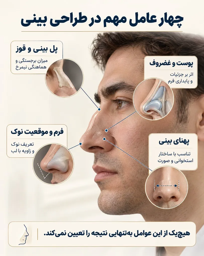 چهار عامل مهم در طراحی بینی