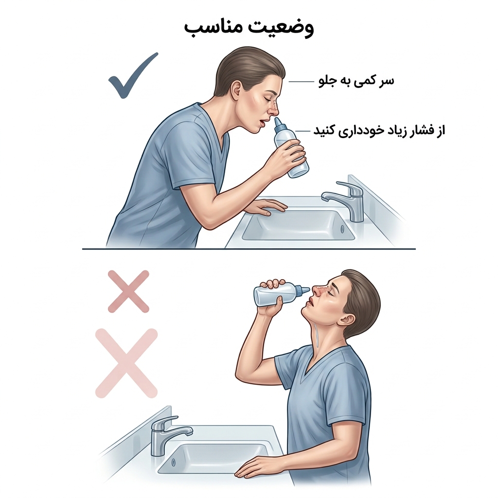 اینفوگرافیک روش صحیح شستشوی بینی بعد از عمل
