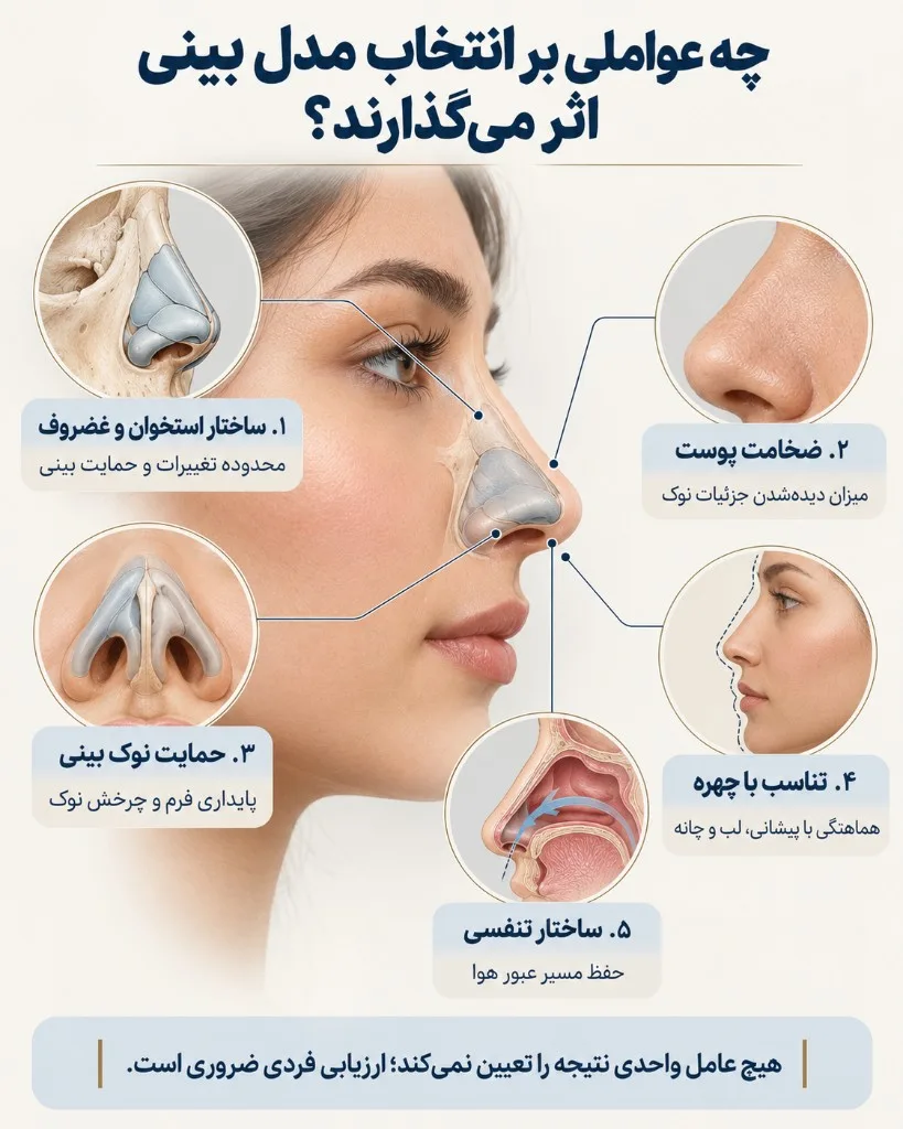 چه عواملی بر انتخاب مدل بینی اثر می‌گذارند
