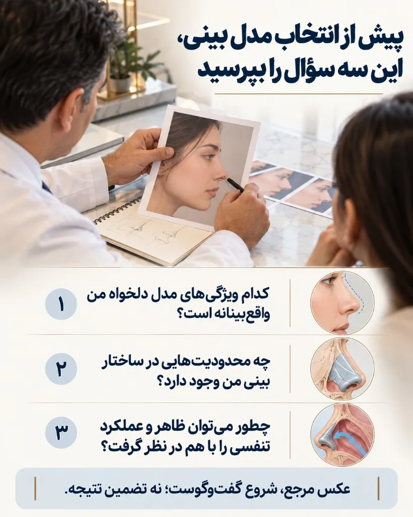 پیش از انتخاب مدل بینی این سه سؤال را بپرسید