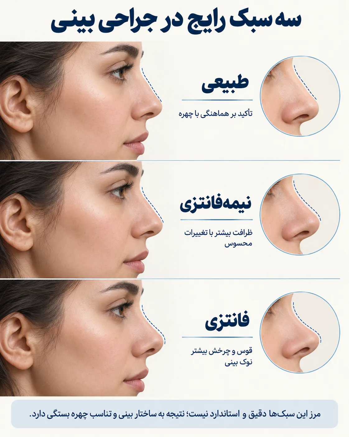 سه سبک رایج در جراحی بینی