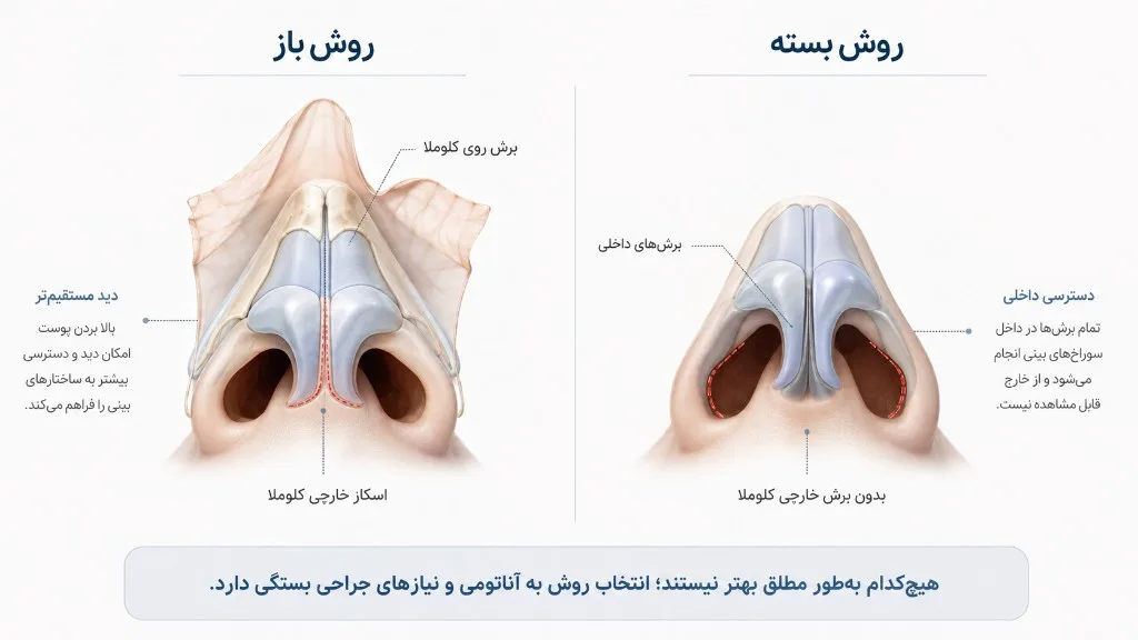 مقایسه دسترسی باز و بسته