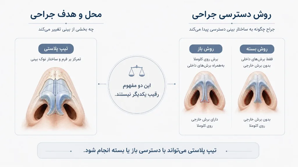 تیپ پلاستی در برابر روش دسترسی
