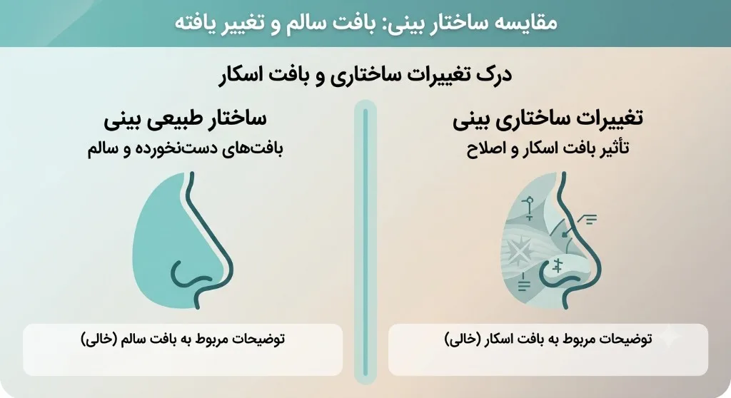 مقایسه ساختار بینی طبیعی با بینی تغییر‌یافته