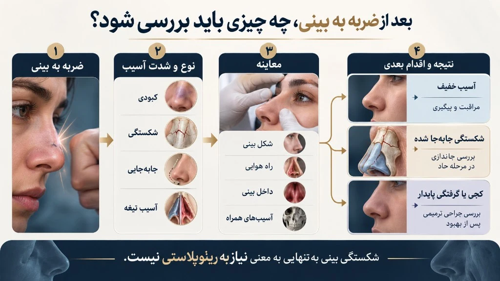 بعد از ضربه به بینی، چه چیزی باید بررسی شود؟