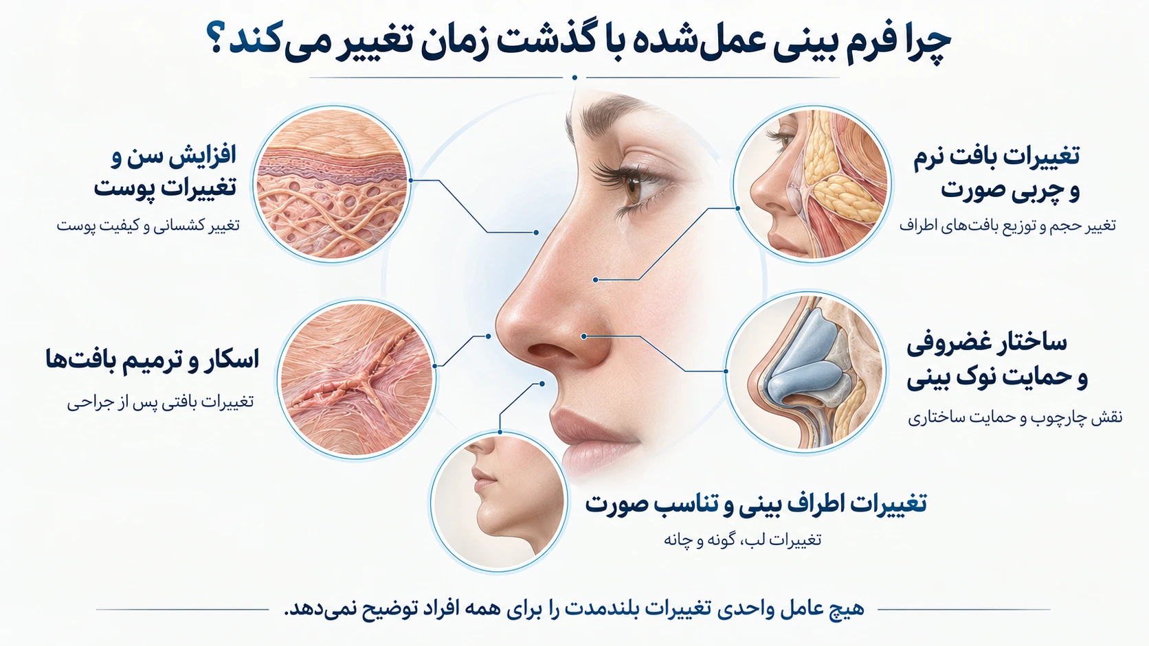 نقش پوست، بافت نرم، اسکار، حمایت غضروفی و تناسب صورت در ظاهر بلندمدت بینی