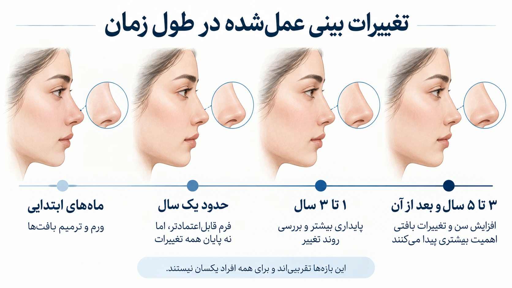 بازه‌های تقریبی تغییر ظاهر بینی پس از عمل، از ورم اولیه تا تغییرات چندساله