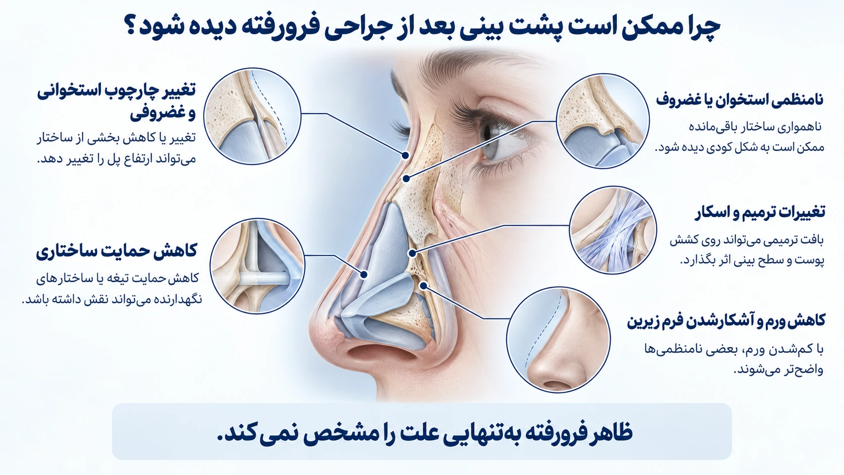 علت‌های احتمالی فرورفتگی پل بینی شامل تغییر چارچوب، کاهش حمایت، اسکار و کاهش ورم