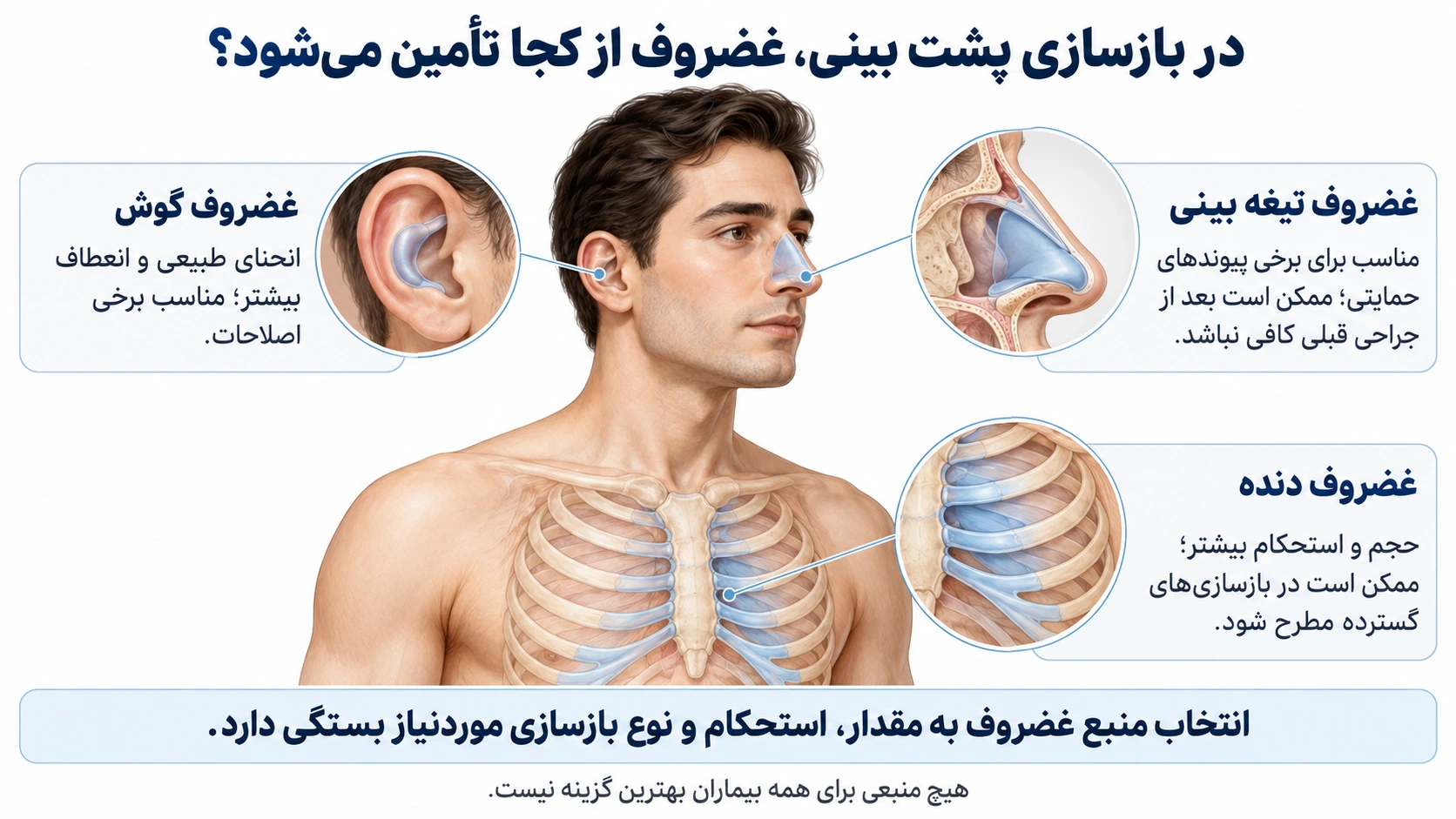 منابع احتمالی غضروف تیغه بینی، گوش و دنده برای بازسازی پشت بینی