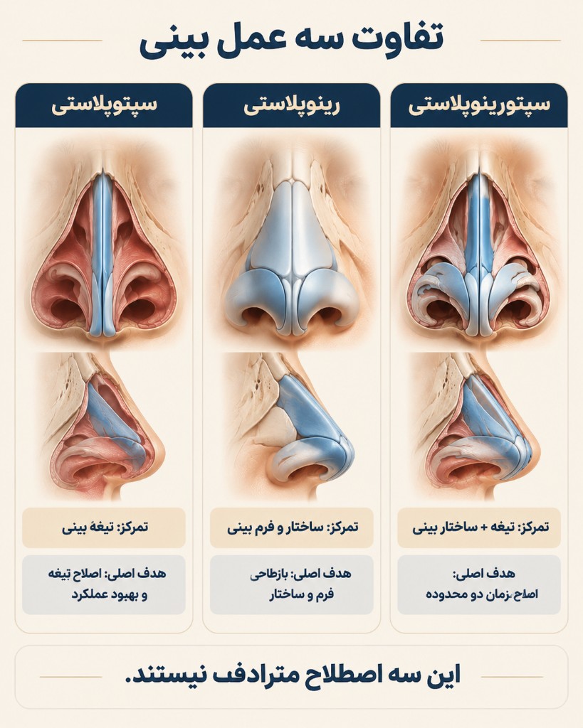 تفاوت سه عمل بینی از روبرو و نیمرخ
