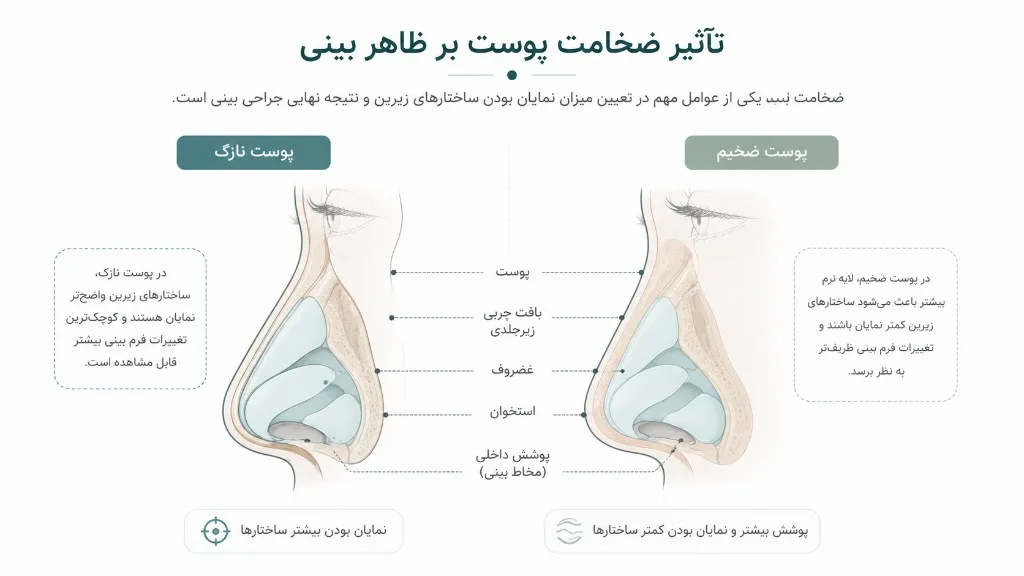 تأثیر ضخامت پوست بر ظاهر بینی