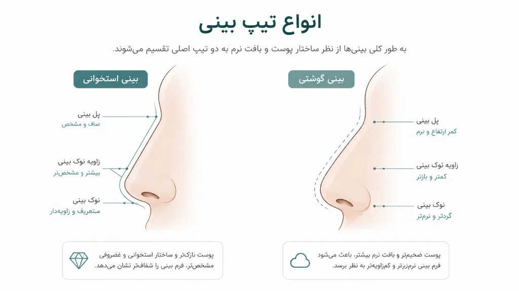 مقایسه انواع تیپ بینی