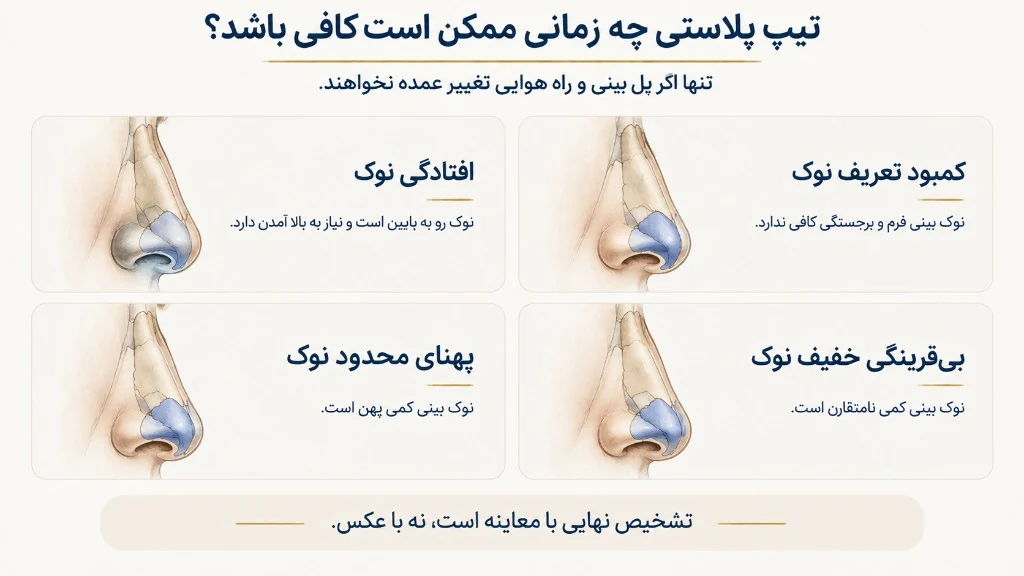 نمونه‌های مفهومی نگرانی محدود به نوک