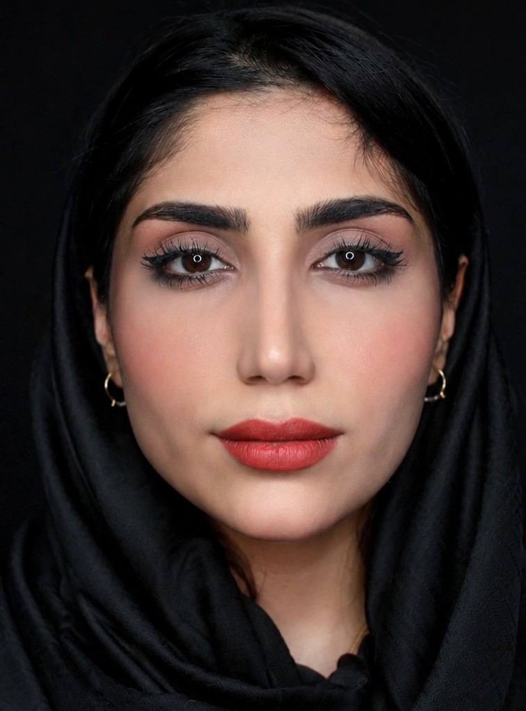 بعد — نتیجه جراحی زیبایی بینی — نمونه ۳